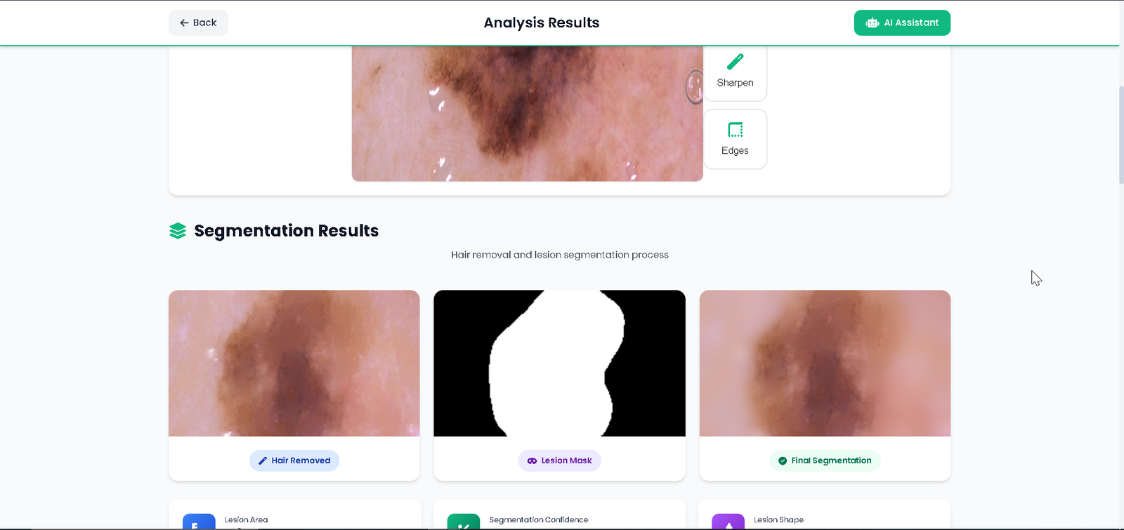 Skin Cancer Analysis Platform gallery item 5